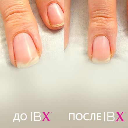 Укрепление ногтей: гелем, акрилом и восстановление ногтей «IBX»